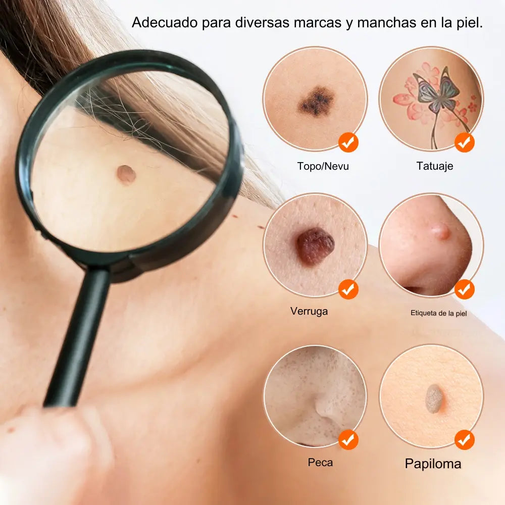 PLUMA LASER PLASMA™ ELIMINADOR DE MANCHAS Y VERRUGAS