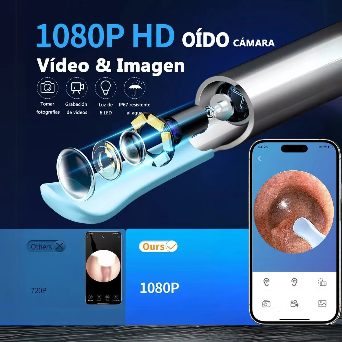 LIMPIADOR DE OÍDOS INTELIGENTE CON CÁMARA HD👂🏻