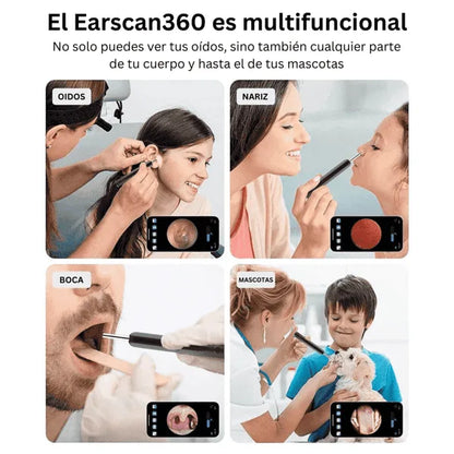 LIMPIADOR DE OÍDOS INTELIGENTE CON CÁMARA HD👂🏻